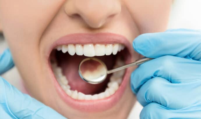 Dental technician wearing blue gloves, using a mirror instrument to look in a woman's mouth