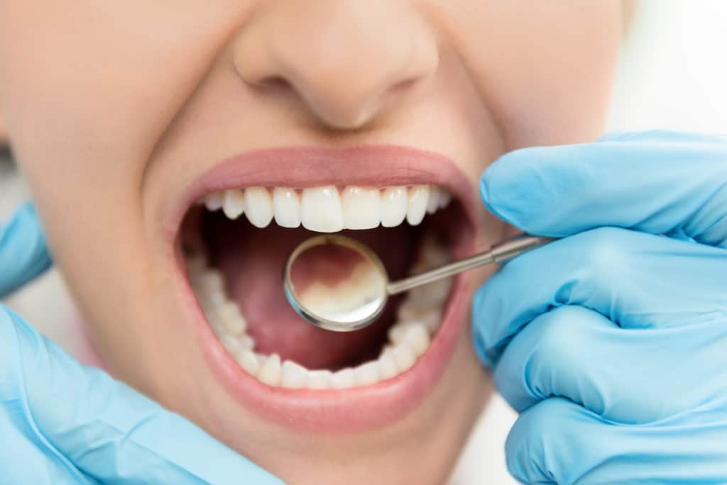 Dental technician wearing blue gloves, using a mirror instrument to look in a woman's mouth