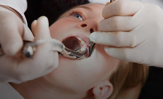 Young child getting a tooth extracted