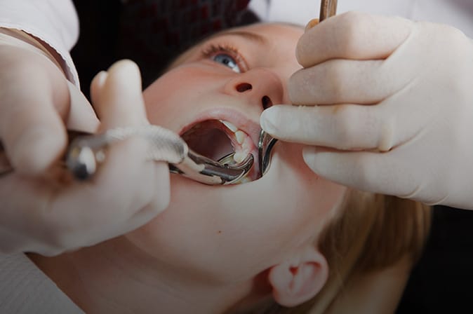 Young child getting a tooth extracted