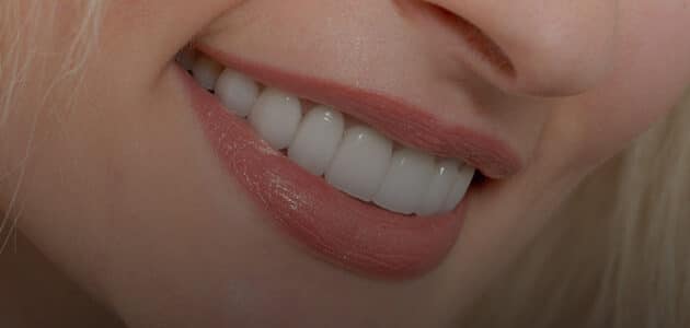 Lower half of a woman's smiling face, close up of her whitened teeth